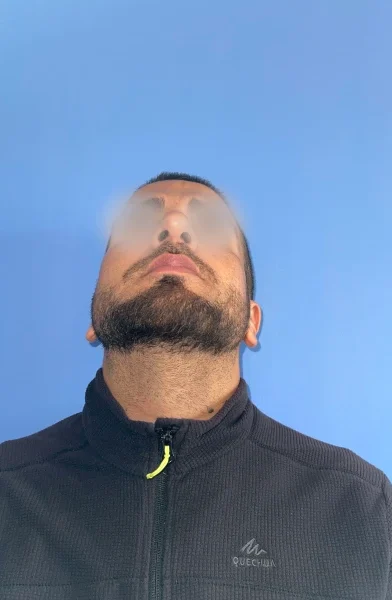 Cas 1