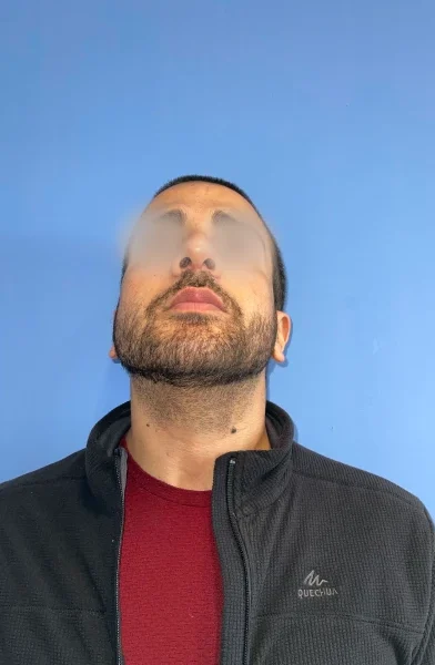 Cas 1