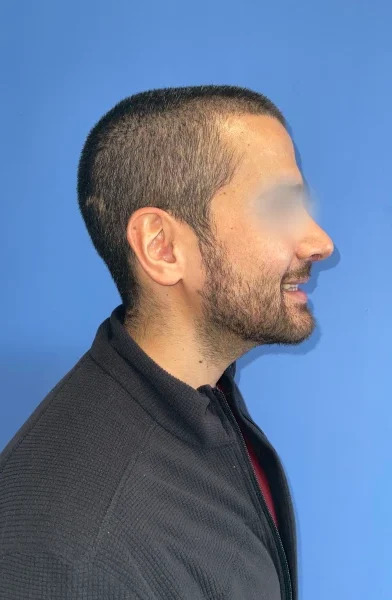 Cas 1