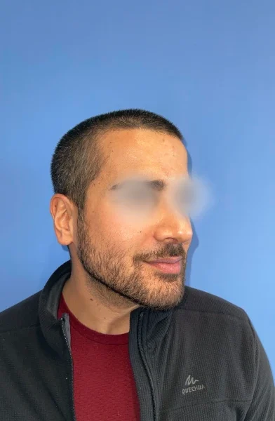 Cas 1