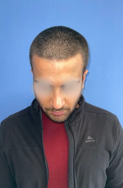 Cas 1