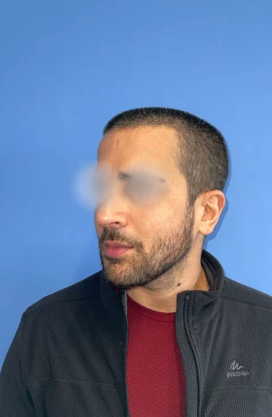 Cas 1