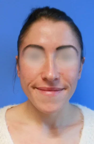 Cas 23